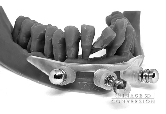 image3dconversion i3d CBCT to STL computer guided surgery DICOM to STL	Dental Implant Digital Dentistry Restorative dentistry